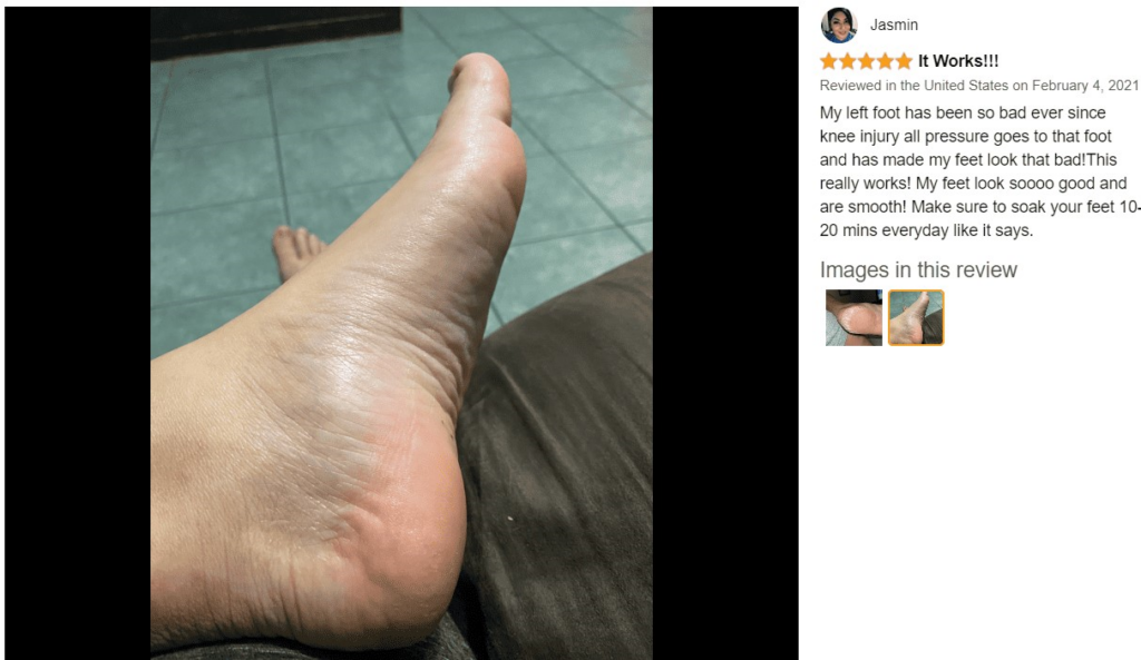 foot peel mask reviews 