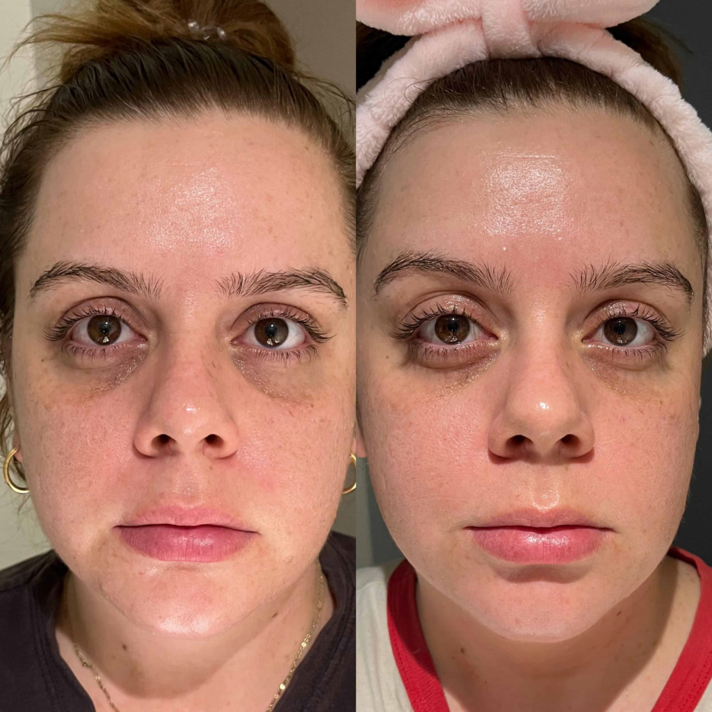 eye cream before and after 